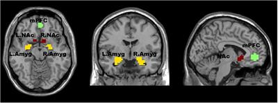 Impaired effective functional connectivity in the social preference of children with autism spectrum disorder